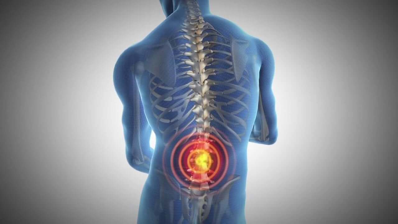 herniated-lumbar-disk