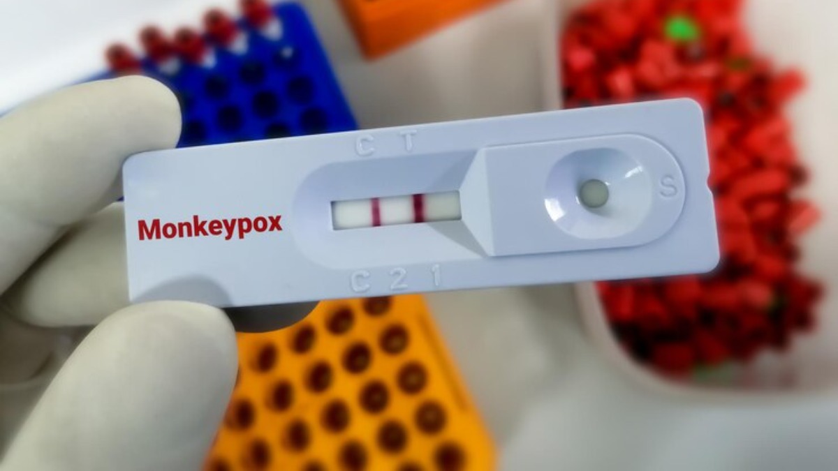 monkeypox-test-kit